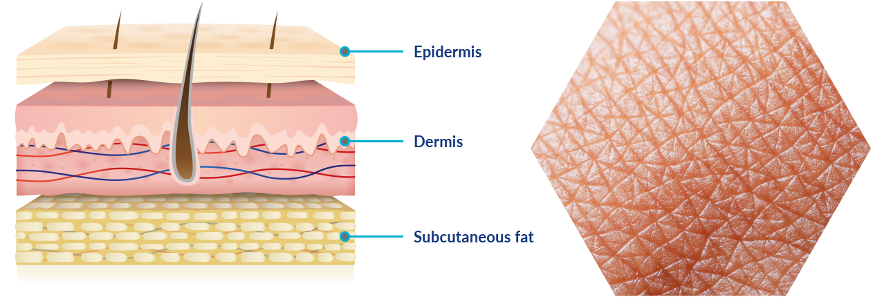 Basic skin anatomy